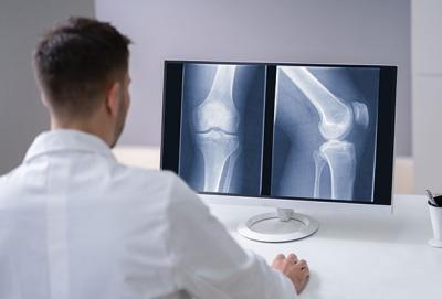 doctor viewing x-ray